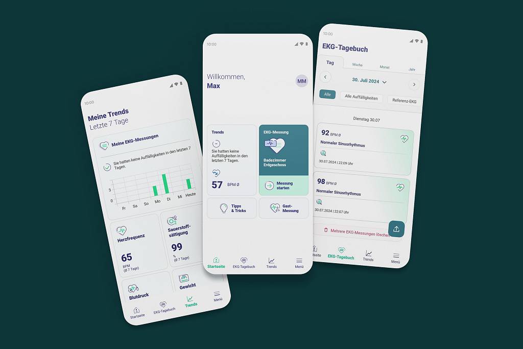 Smartphone Screens mit der Startseite, Trends und Tagebuch aus der EKG-seat-App