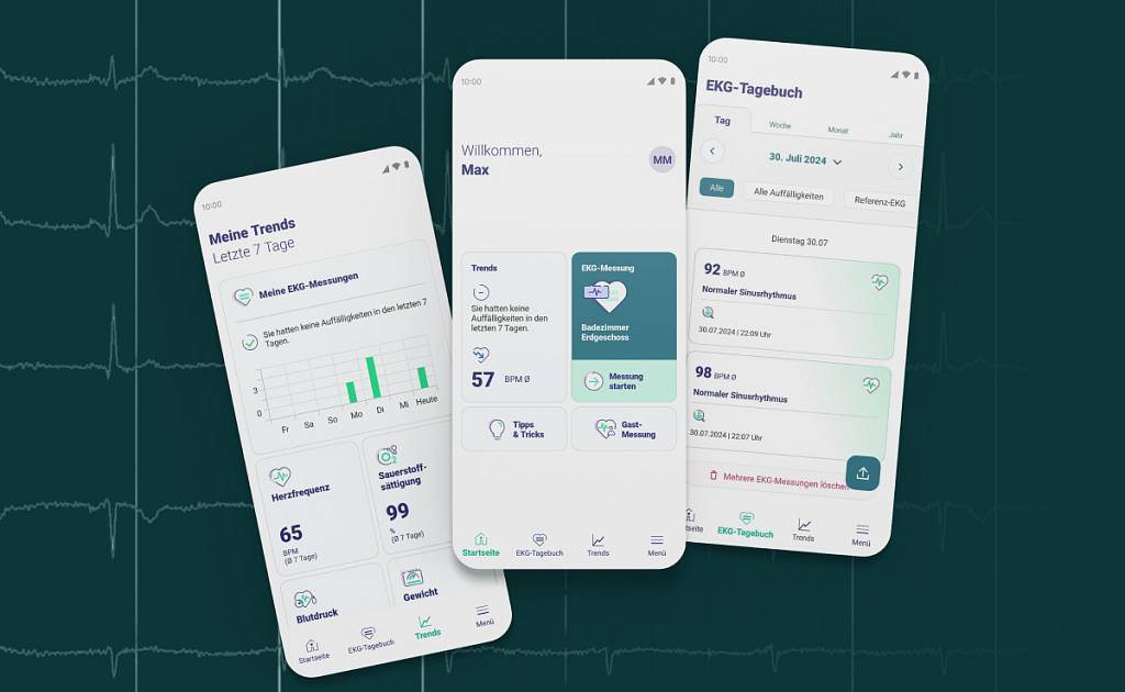 Drei Smartphone-Bildschirme aus der EKG-seat App mit EKG-Messdaten, Trends und einem digitalen EKG-Tagebuch.